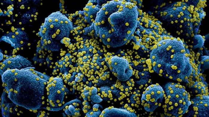 coronavirus-SARS-COV-2-noticias-covid-19