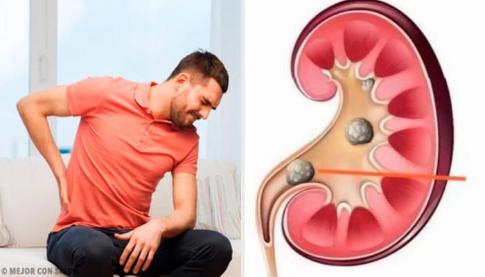 Hombre con dolor en riñones