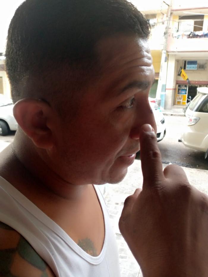 Agresión. Christian Tomalá muestra parte de las heridas que sufrió.