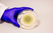 Una muestra de Aspergillus flavus cultivada en el laboratorio Gao.