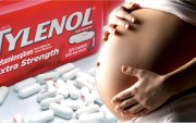 Una foto referencial sobre el comentario del presidente Donald Trump sobre el Tylenol.