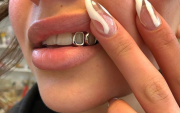 Los grillz son una moda que puede poner en riesgo la salud bucal.