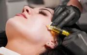 El plasma rico en plaquetas se ha convertido en uno de los tratamientos estéticos más buscados por su efecto regenerativo y revitalizante en la piel del rostro.