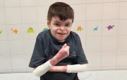 Leo, de 12 años, inicia en Sevilla la terapia génica Vyjuvek para tratar la Piel de Mariposa.