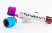 Referencial. Muestras de laboratorio utilizadas en pruebas para detectar hantavirus.
