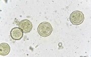 Oocistos de Cryptosporidium, parásito responsable de brotes de diarrea en EE. UU.