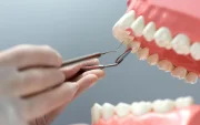 El programa de implantes dentales gratuitos, de la Universidad Católica de Santiago de Guayaquil (UCSG) tendrá 40 cupos.