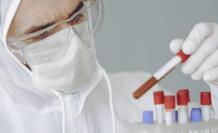 Coronavirus. Pexels. 5 de junio de 2020.