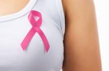 imagen sobre el cáncer de mama