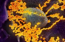 imagen de microscopio electrónico que muestra (objetos en amarillo) al SARS-CoV-2, el virus que causa el brote del coronavirus COVID-19