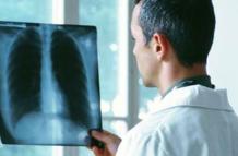 Pulmones