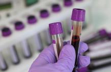 sangre-examen-laboratorio