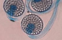 Imagen tomada a través de un microscopio que muestra un hongo Circinella lampensis.