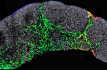 Un ganglio linfático de un ratón en el que se visualizan los capilares linfáticos (verde) y los exosomas tumorales (rojo) que dirigirán los primeros momentos de la metástasis.
