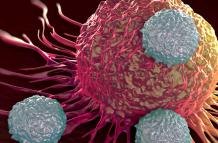 cáncer
