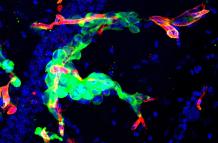 Imagen de la metástasis en cerebro de ratón cedida por el CNIO. En verde, células tumorales que permanecen ‘escondidas’ después de una cirugía y que actúan como potenciales semillas para la reaparición de la metástasis.