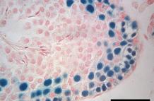 Sección transversal de un testículo de ratón infértil que muestra células germinales y espermatozoides de rata previamente congelados.