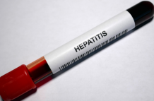 Hepatitis