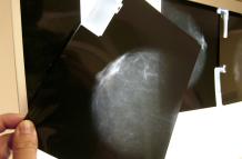 prueba radiológica de mama