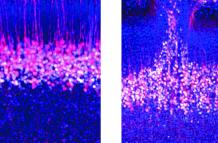 Neuronas piramidales de la capa cinco del córtex en ratones normales (izquierda) comparados con ratones con el gen del autismo eliminado (derecha), mostrando un parche de corteza desorganizada.