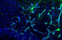 Metástasis en cerebro de ratón. Se aprecia cómo la metástasis (verde más claro) interacciona con una neurona (verde más intenso). Esta neurona está marcada específicamente para su estudio, pero la metástasis está interaccionando con muchas más.