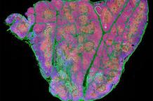 Sección de tejido completo de un timo humano después del nacimiento, que muestra timocitos (rojo), células epiteliales (cian) y células madre junto a zonas de fibronectina (verde).