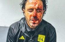 Fabio Grosso