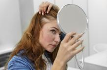 Trucos para disminuir la caída del cabello