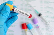 Una de las áreas más prometedoras de la investigación del TB-500 reside en su posible implicación en la cicatrización de heridas