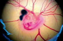 El cerebro de las ave