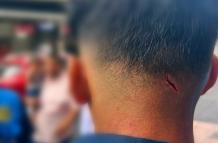 herida metropolitano guayaquil