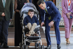 Leo - niño con piel de mariposa