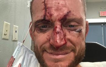 Davey Grant UFC