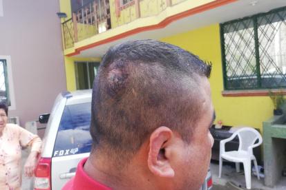 Así quedó la cabeza del hombre que se enfrentó a golpes con Jaime Iván Kaviedes.