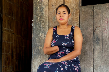 Unos 20 cortes entre su cabeza, cuello, brazos, tórax y cadera fue el resultado del ataque de su expareja.