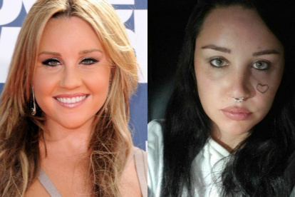 Amanda Bynes en un antes y después. Su cambio físico es notorio.