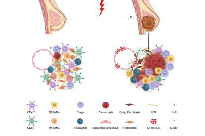 Un equipo internacional de investigadores ha demostrado cómo la quimioterapia despierta células cancerosas latentes (a la izquierda), lo que provoca el crecimiento del tumor (a la derecha).