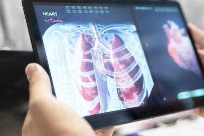Medics and his staff meet to discuss lungs radiography for patient care strategy in a treatment center. Medical team analyze organs x rays and healthcare records to focus on diagnostics. Close up.