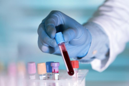 Una prueba rutinaria de sangre permitirá conocer cuáles son las probabilidades de desarrollar ciertas enfermedades.