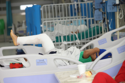 Al hospital Francisco Icaza Bustamante han ingresado 21 infantes con quemaduras.