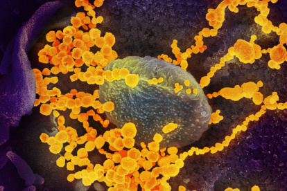 Imagen de microscopio electrónico que muestra (objetos en amarillo) al SARS-CoV-2, el virus que causa el brote del coronavirus COVID-19.
