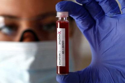 Hasta ayer, se habían registrado 1.627 casos de Covid-19 a nivel nacional.