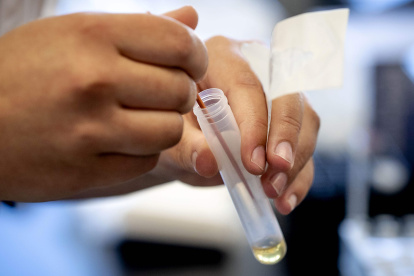 A picture taken on March 31, 2020 shows testing equipment for infectious diseases like the novel coronavirus (Covid-19) in the Microvida laboratory in the Bravis hospital in Roosendaal, The Netherlands, amid the outbreak of COVID-19 (novel coronavirus).  - Netherlands OUT
 / AFP / ANP / Sem VAN DER WAL

 NETHERLANDS-HEALTH-VIRUS