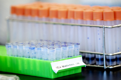A picture taken on March 31, 2020 shows testing equipment for infectious diseases like the novel coronavirus (Covid-19) in the Microvida laboratory in the Bravis hospital in Roosendaal, The Netherlands, amid the outbreak of COVID-19 (novel coronavirus).  - Netherlands OUT
 / AFP / ANP / Sem VAN DER WAL

 NETHERLANDS-HEALTH-VIRUS