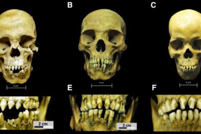 Imagen de los cráneos de los esclavos africanos que acompaña el estudio científico.