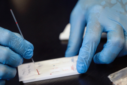 INVESTIGACIÓN. Los anticuerpos son moléculas producidas por el sistema inmunológico para combatir las infecciones en el organismo, ya sean víricas o bacteriológicas.