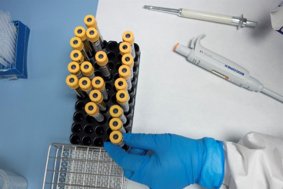 Hay más de 100 proyectos científicos que buscan la vacuna contra el nuevo coronavirus o SARS-CoV-2, causante del COVID-19.