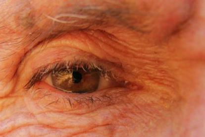 Un implante para tratar la degeneración macular por la edad puede espaciar su tratamiento hasta 15 meses.