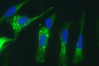 Células de adenocarcinoma pancreático mostrando activación de autofagia (puntos verdes) en respuesta al tratamiento con ABTL0812.