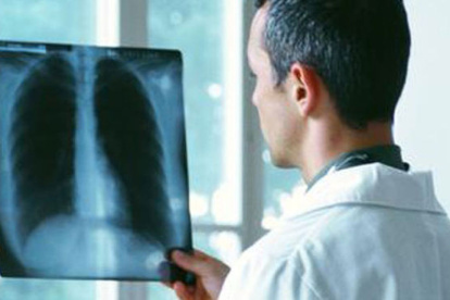 La salud pulmonar también se ve afectada entre quienes sufren de Síndrome Metabólico.